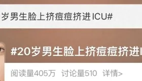 20 岁男生挤痘进 ICU，脸部 “危险三角区” 痘痘为啥不能挤？有何风险？