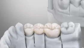 国际首例！空军军医大学太牛了，前牙缺损当天补好，和真牙一模一样！