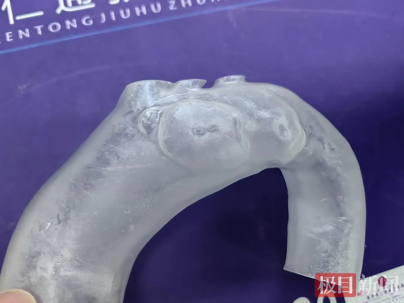 武汉大学人民医院如何救治高龄危重主动脉疾病患者?“3S”理念与 3D 打印技术有何妙处? 武汉大学人民医院如何救治高龄危重主动脉疾病患者?“3S”理念与 3D 打印技术有何妙处?