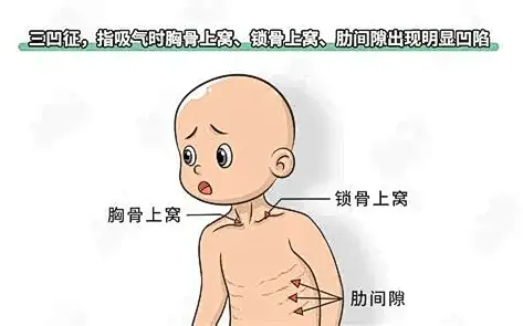 大范围降温,儿童流感高发,甲型 H3N2 重症有何症状?如何用药与预防? 大范围降温,儿童流感高发,甲型 H3N2 重症有何症状?如何用药与预防?