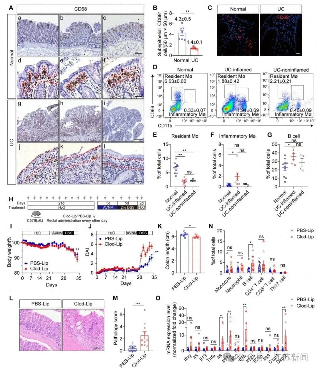 南京大学团队新发现：气单胞菌新亚种或为溃疡性结肠炎元凶，有何突破与前景？