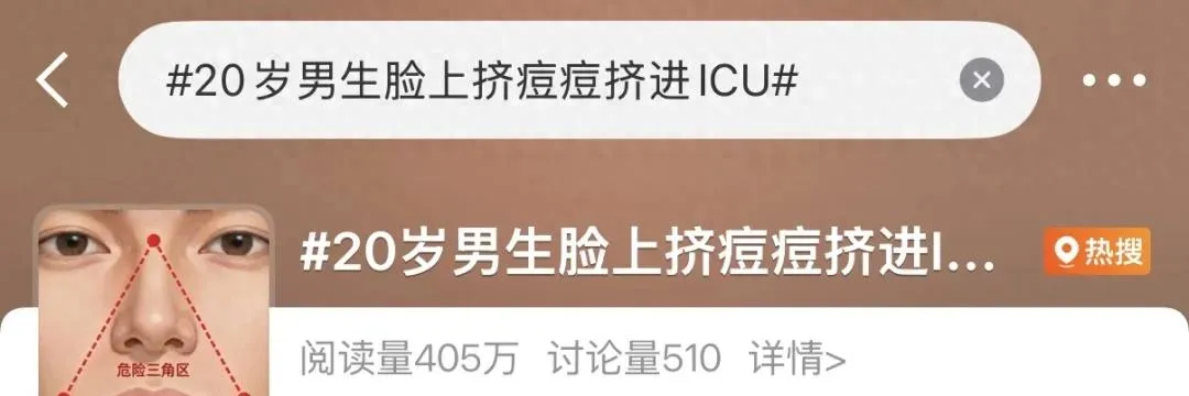 20 岁男生挤痘进 ICU，脸部“危险三角区”痘痘为啥不能挤？有何风险？