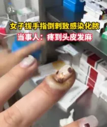 不要拔！不要拔！有人因此感染……快住手