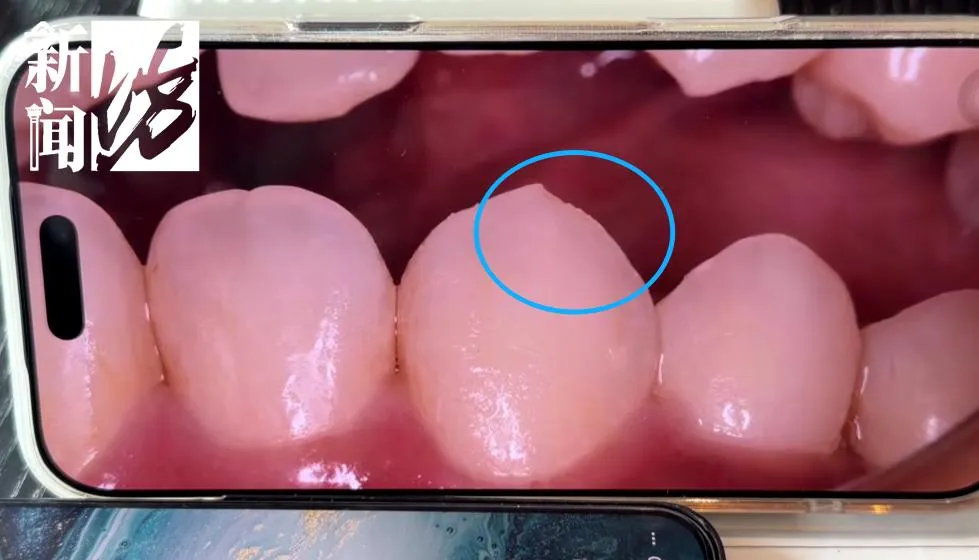 维权遭遇“标签化”报复？患者补牙纠纷后发现病历被注“精神病史，拒绝接诊”